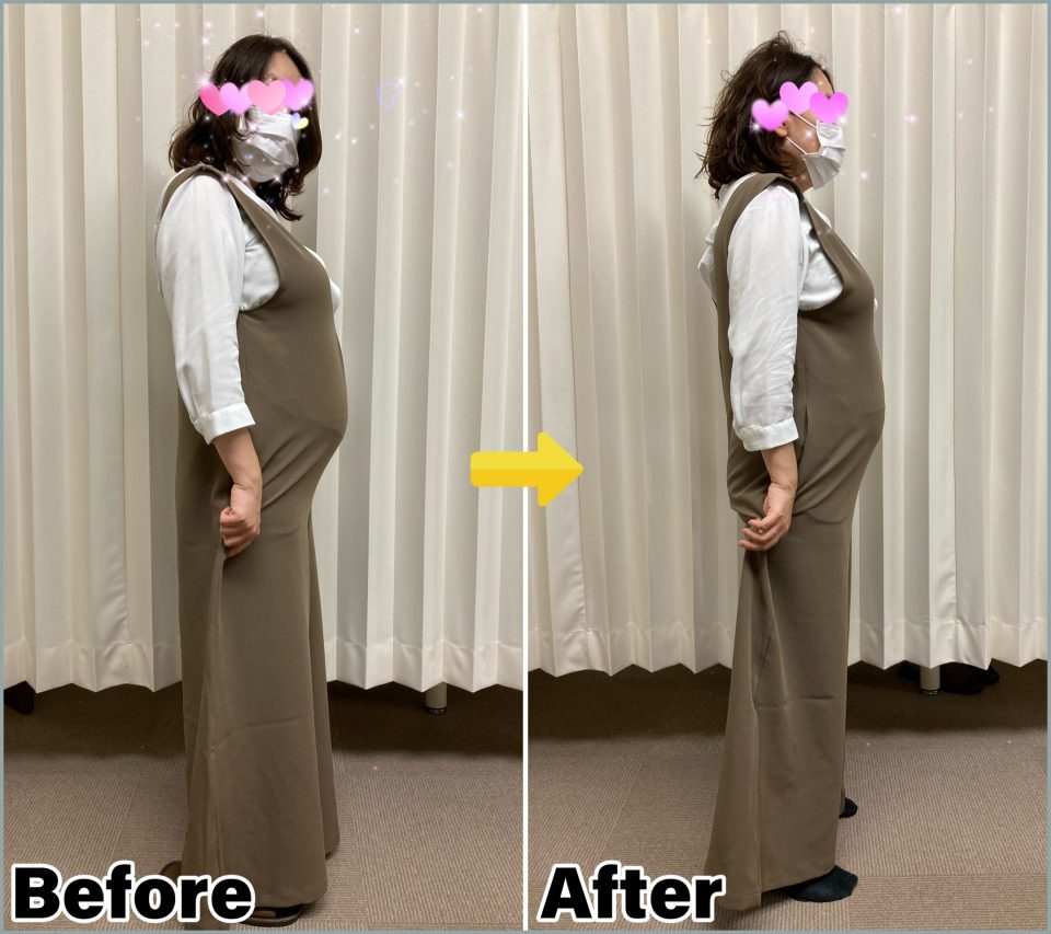 妊婦整体でお腹がコンパクトになった写真
